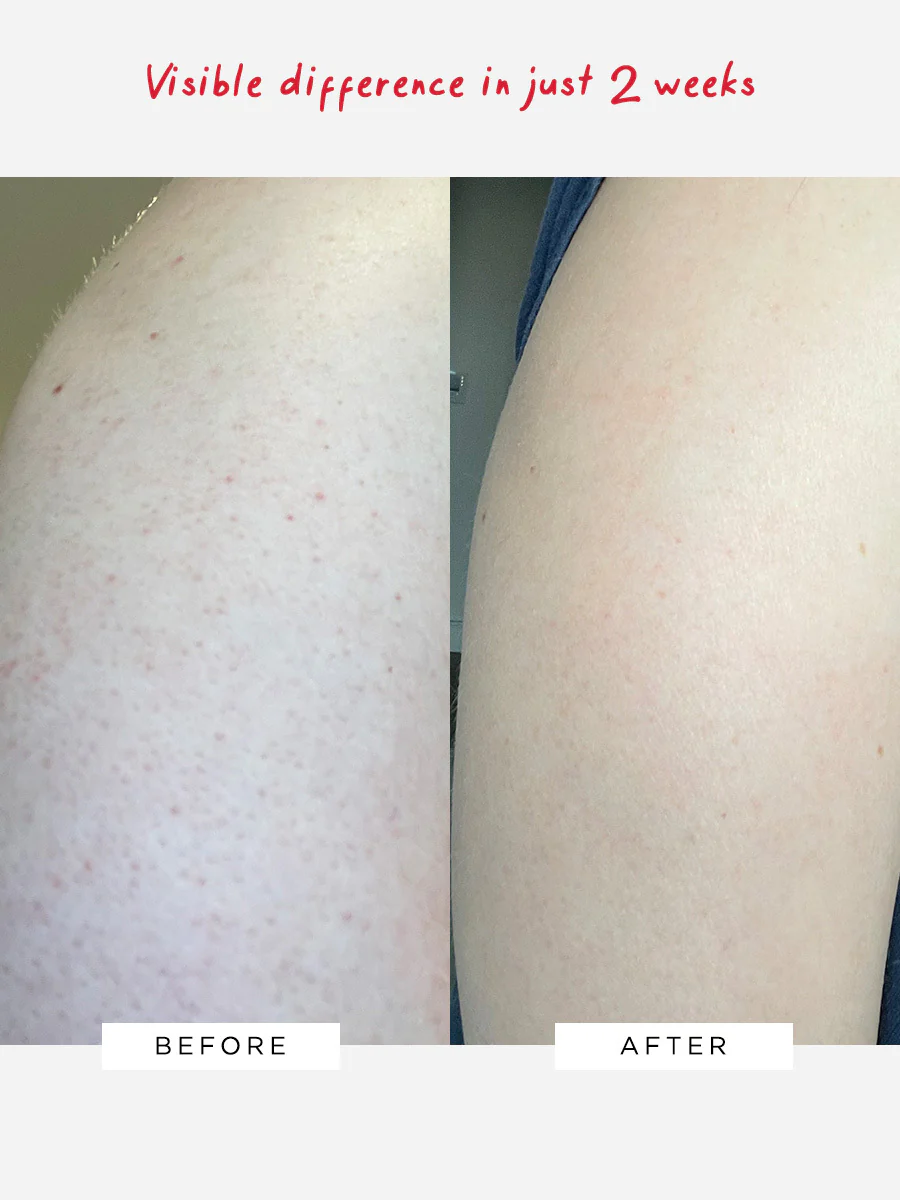 Flawless Body Therapy AHA Body Lotion - Image 3